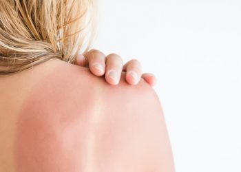 Uruguay ocupa el primer lugar en Latinoamérica en incidencia de cáncer de piel