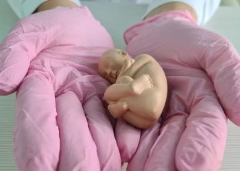 ¿Por la sola voluntad del Dr. Briozzo?