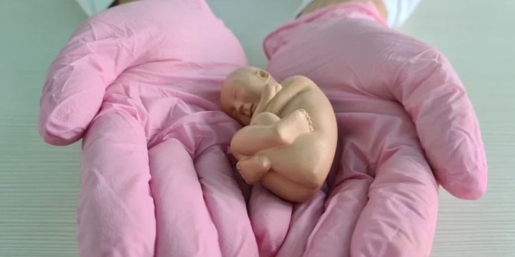 ¿Por la sola voluntad del Dr. Briozzo?